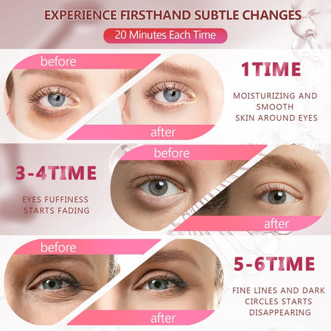 Pink Undereye Mask (60 Pcs), Collagen Hydrating Gel Pads, Reduce Puffiness, 30 Pairs Under Eye Patches for Dark Circles Puffy Eyes Treatment, Wrinkle, Women Men Beauty Personal Skin Care Products