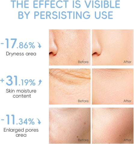 Milk Skin Care Sets & Kits - Teenage Girls Gifts - Milk Skincare Set for Teen Skincare - Gifts For Women - Travel Skincare Set Daily Face Care - Deep Hydrating Smoothing 23PCS