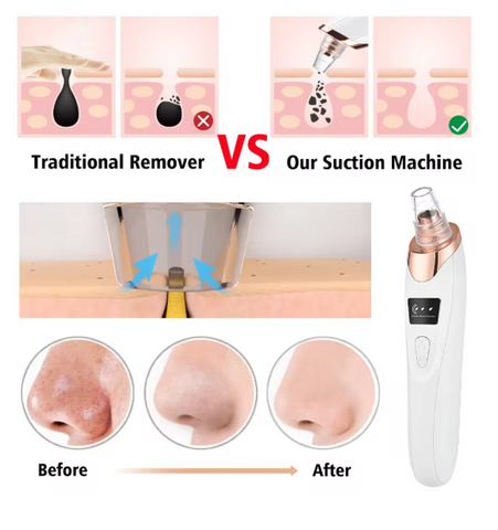 Blackhead Remover Vacuum Pore Adsorber Face Cleaner Electric Pimple